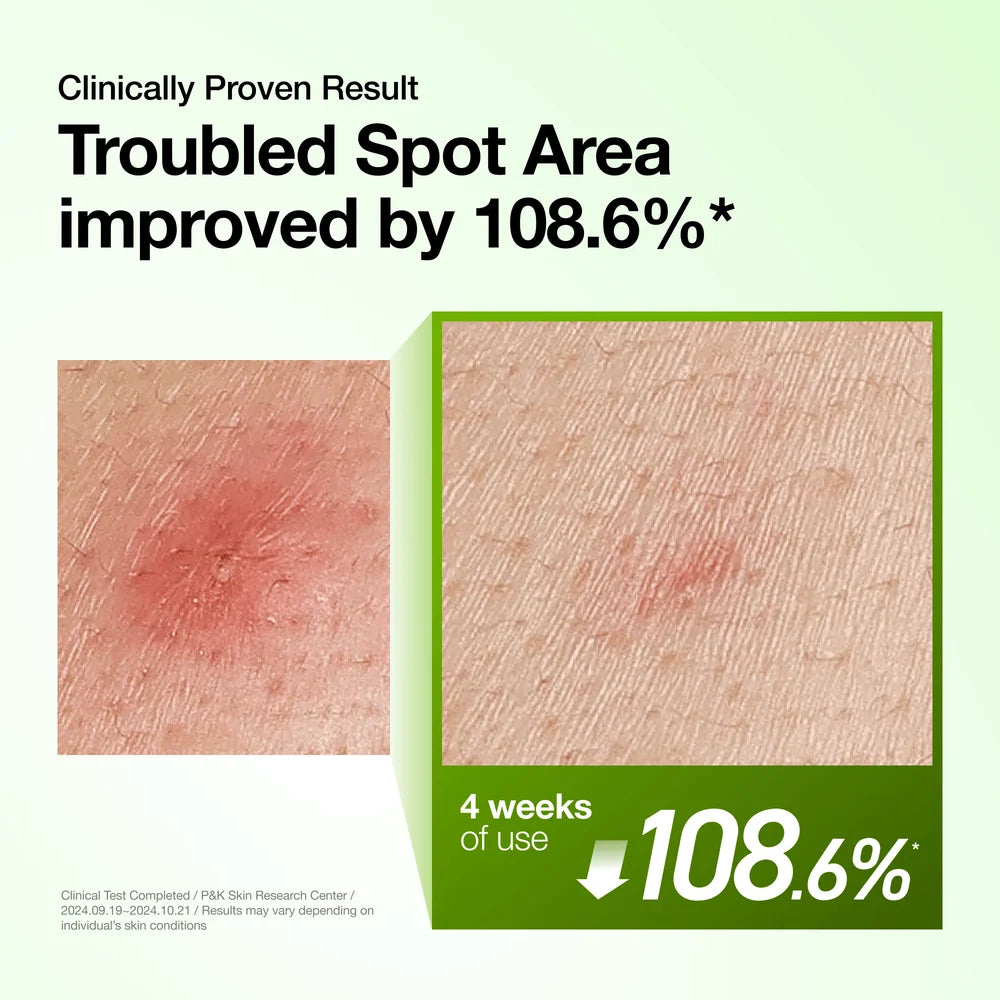 ANUA-Spotless Skin Duo