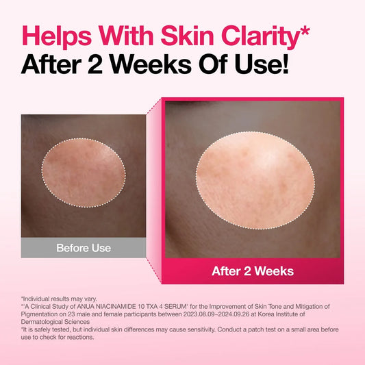 ANUA-Spotless Skin Duo