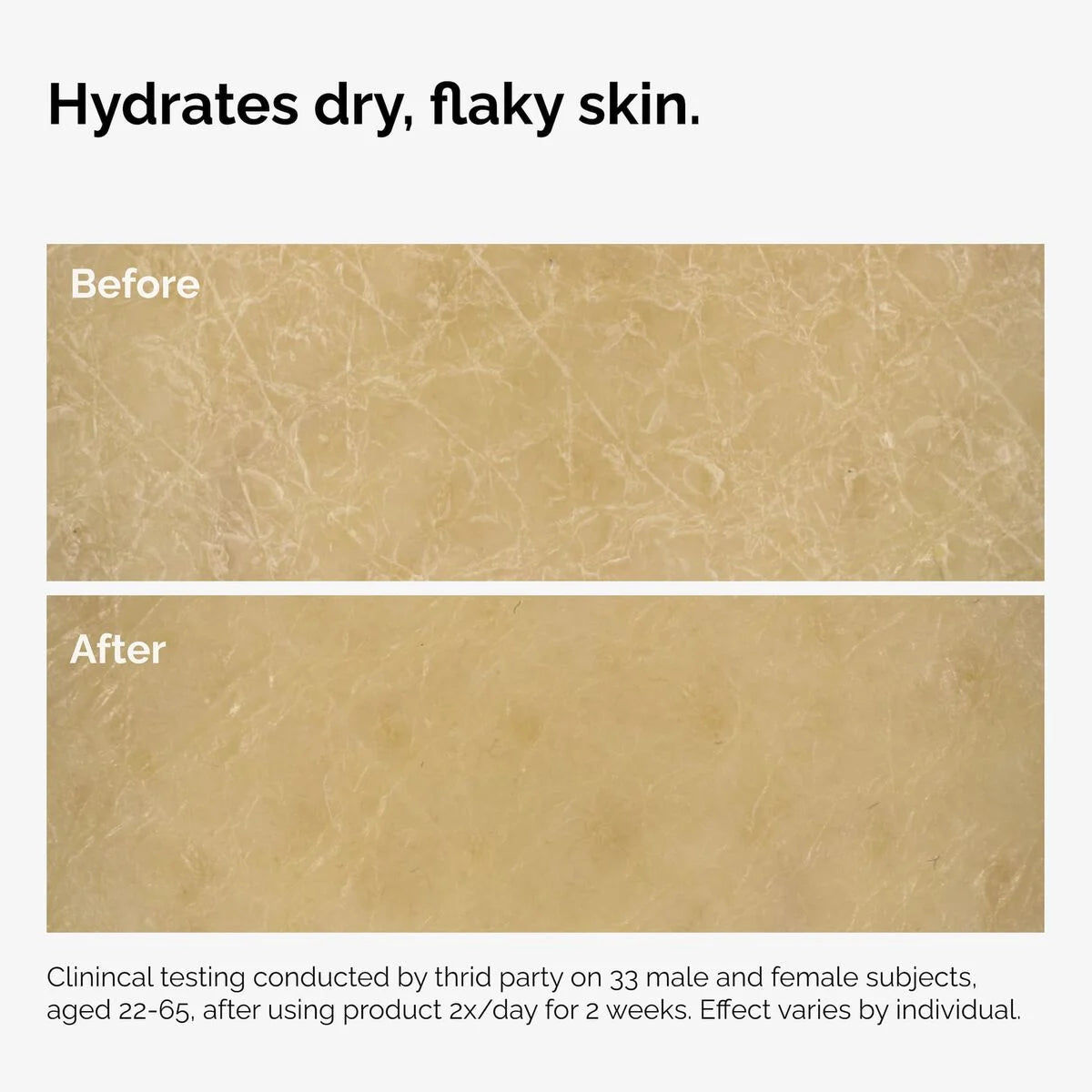 The Ordinary Body Care Collection