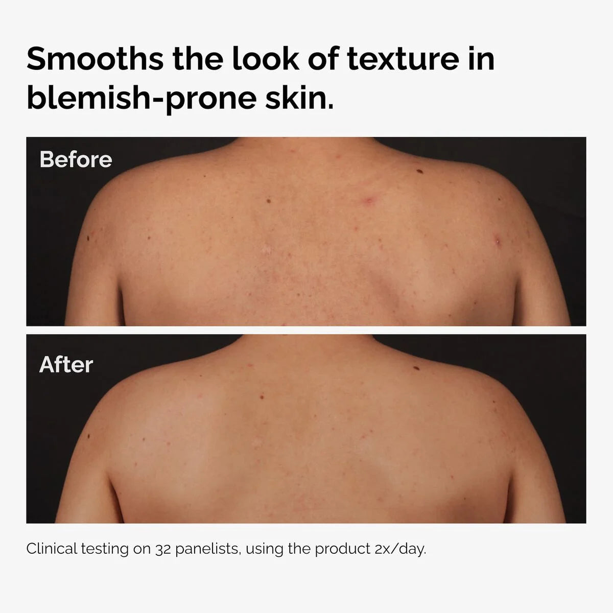The Ordinary Body Care Collection